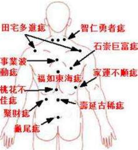 左邊屁股有痣|痣的位置与命运：屁股上有痣有什么意义